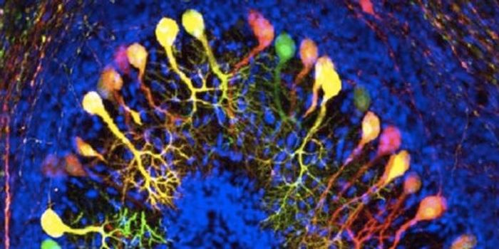 Rare Disease Reveals Importance of Transporter in Brain Growth