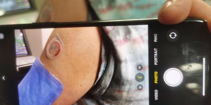 Using Sweat to Diagnose Disease