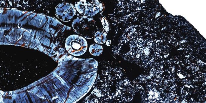 Cancer is at Least 255-Million-Years-Old, New Study Finds