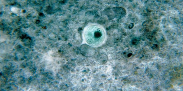 As If Superbugs Weren't Bad Enough, Here's Another Reason Not to Overuse Antibiotics