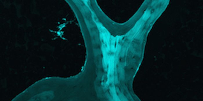 New Understanding of Bones Could Lead to Stronger Materials