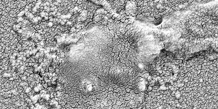 Revolutionizing Our Approach to Antibiotic Resistance