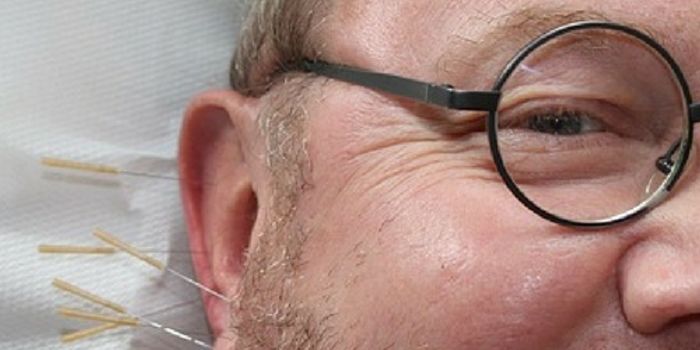 Can Acupuncture Treat Drug Addiction?