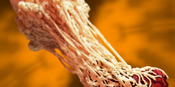 Immunoproteasome Inhibits Repair Function of Macrophages