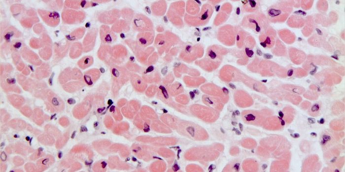 Open Heart Surgery Takes A Toll on Heart Muscle Cells