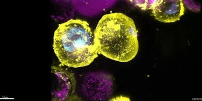 A Gene Variant That Promotes Inflammation is Carried by Millions