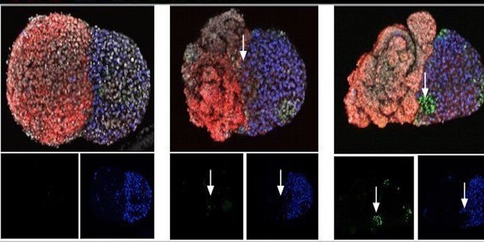 New 3-in-1 organ in a dish set to elevate research and diagnostics