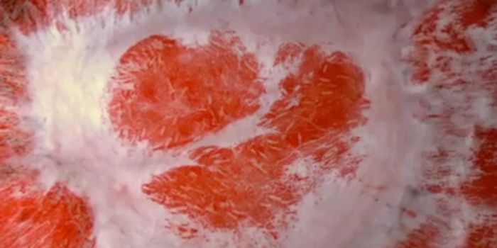 Fat Cells Help Wounds Heal as Healthy Skin Instead of Scars