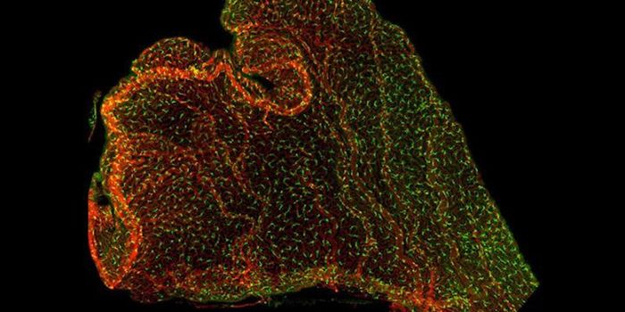 A Small Part of the Brain May Transmit Inflammation From Mom to Fetus