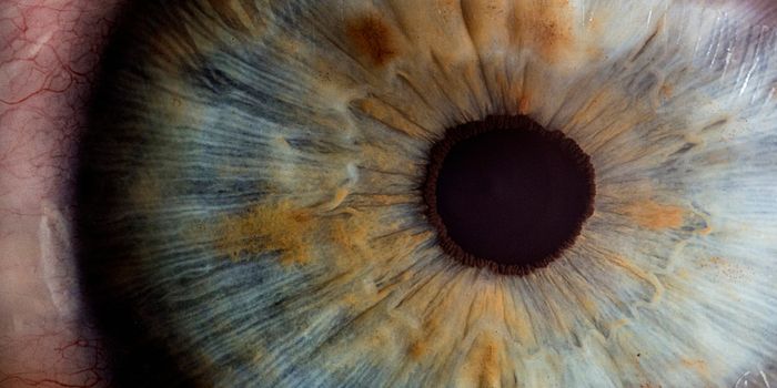 Effective Treatment for Ulveal Melanoma