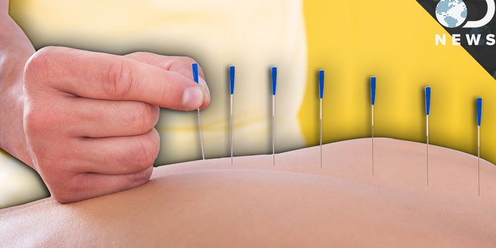 Is Acupuncture Actually a Useful Form of Treatment?