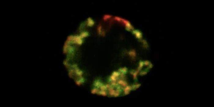 DNA in the Nucleus Observed In a Surprising Formation