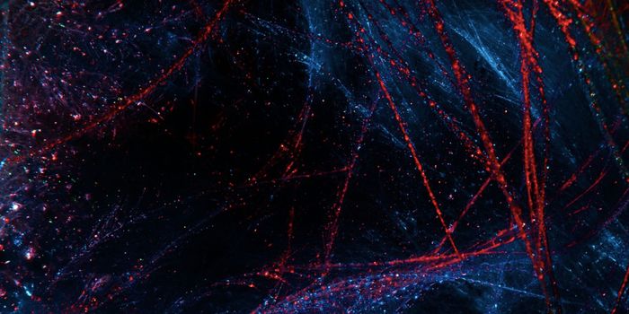 A Specific Microbe is Associated with Worsening Lupus