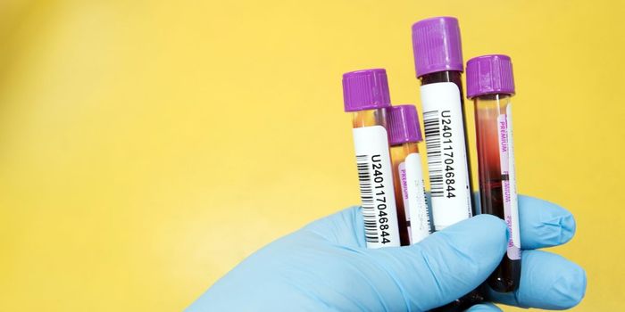 Simple Blood Test Can Detect Depression and Underlying Neurodegeneration