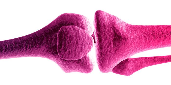 B cells create ‘bone-chewers' in rheumatoid arthritis