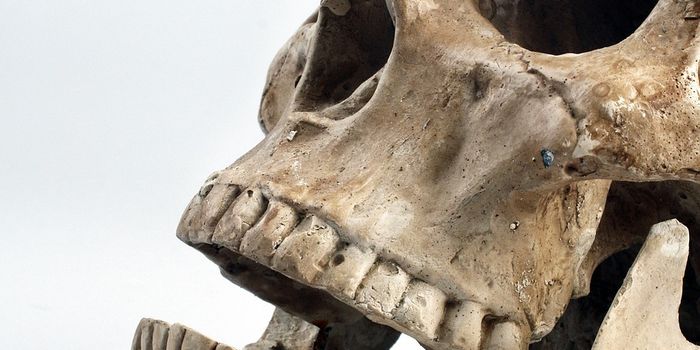 Evidence of Surgical Attempts to Treat Cancer in Ancient Egypt