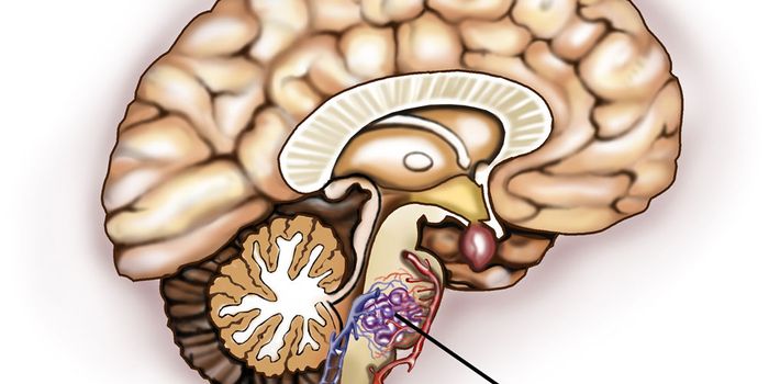 Study Reveals Potential Therapeutic Target for Mysterious Brain Blood Vessel Disorder