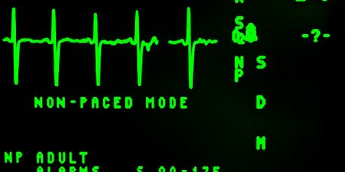 What To Expect During Your Stress Test