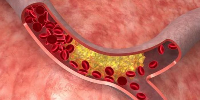 Health Risks Surrounding A Sedentary Lifestyle