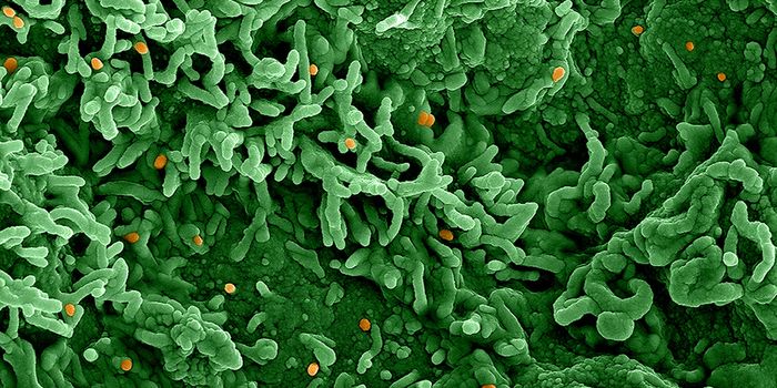 Pox Virus Proteins Can Launch Early Attack on Immune Defense