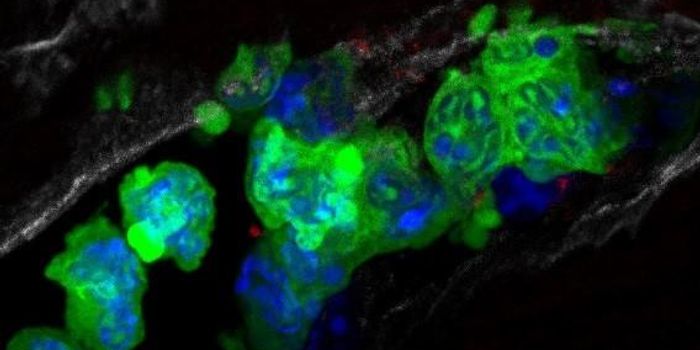 Classic Heart Attack Drug Finds Resurgence