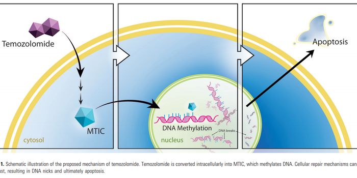 'Acetazolamide' Used To Treat Altitude Sickness, Slows Down the Development of Glioblastoma