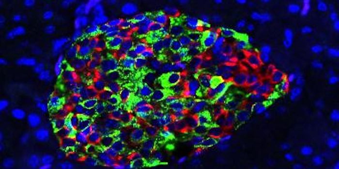 A Genetic Edit Shields Cells That Are Usually Destroyed by Type 1 Diabetes