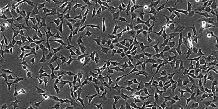 Creating Stem Cells to See Heart Disease Like Never Before