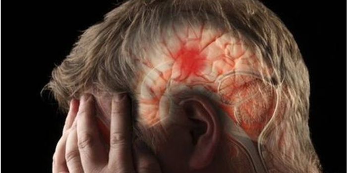 10 Minutes to Diagnose a Stroke