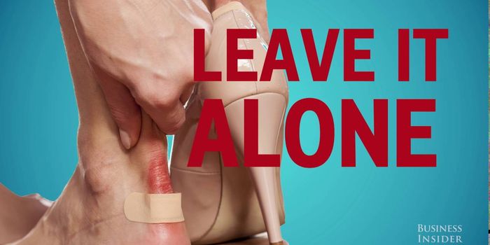 When to Pop a Blister and When to Leave it Alone