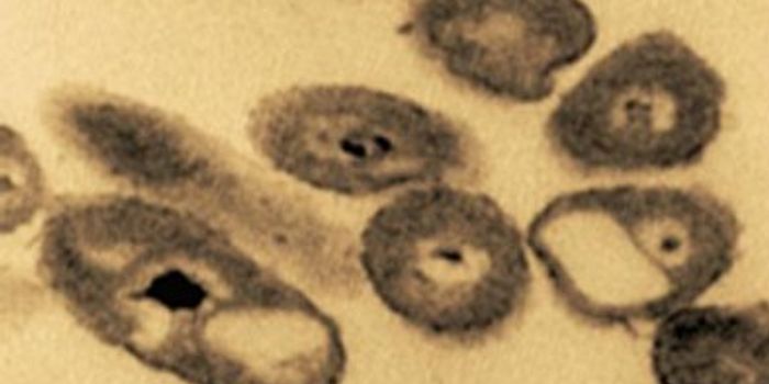 This bacterium can eat oil spills