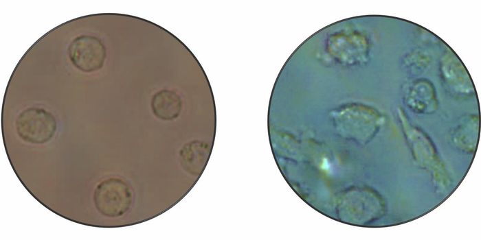 Learning More About Changes in Cancer Cell Identity