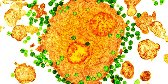 Dormant HIV Can Run, But It Can't Hide