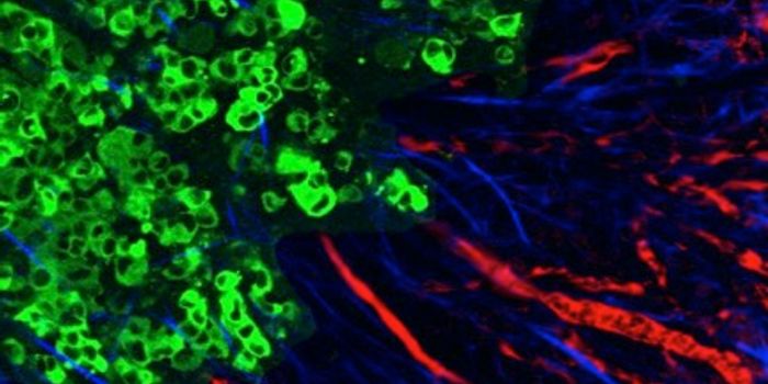 Scientists Discover New Key Player in Cancer Metastasis