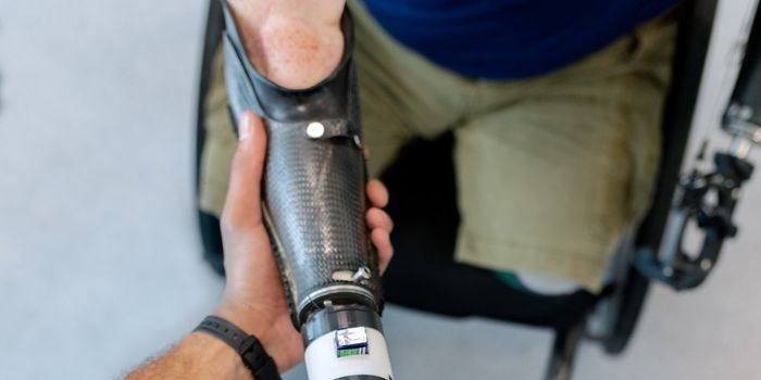 Bionic Arm Effective at Restoring "Natural" Arm Function in Amputees