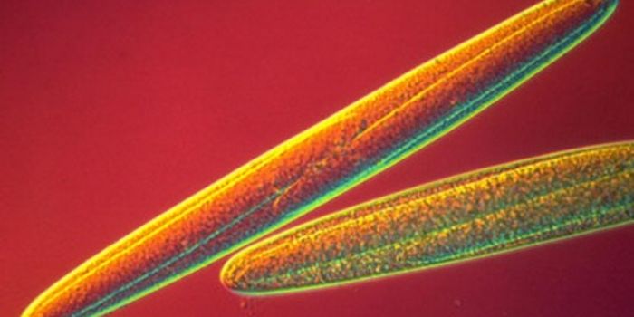 Better Know a Microbe: Epulopiscium