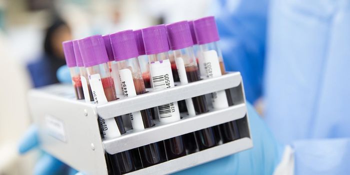 Age-old Immune Components Affecting COVID-19 Severity