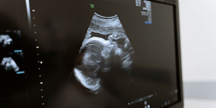 Breast Milk Boosts Brain Development in Preterm Babies