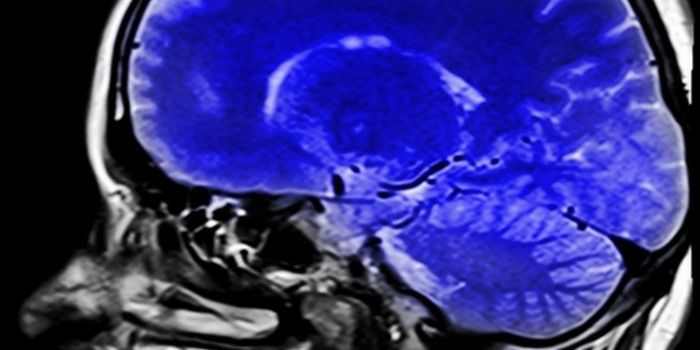 This Patient Had an Air Pocket in the Brain