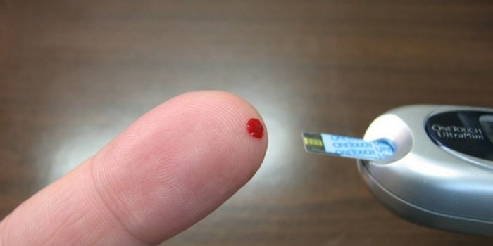 Asian Americans Can't Afford to Forgo Diabetes Screening