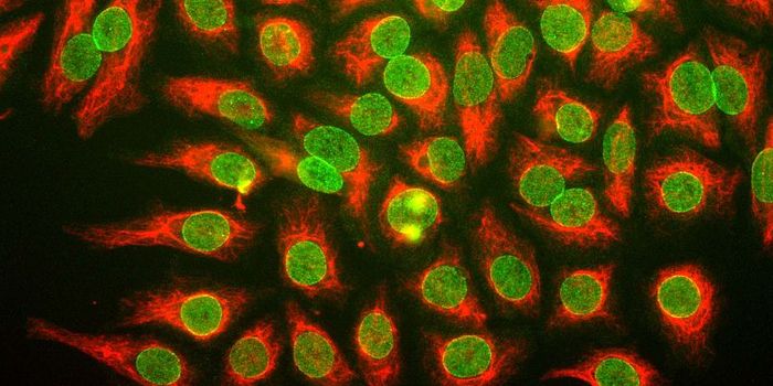 Nuclear Pore Complexes Vital for T Cell Survival