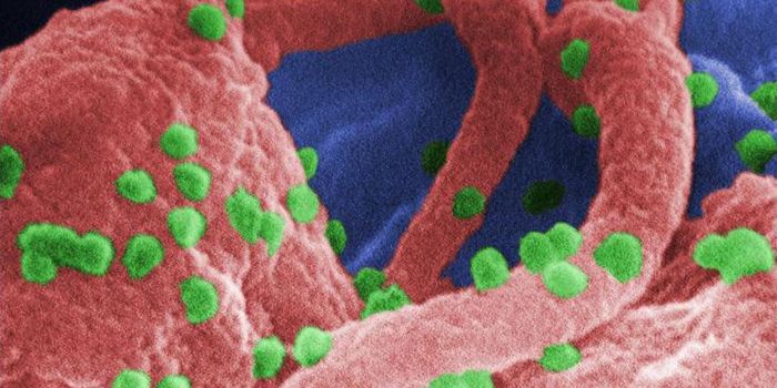 A Stem Cell Transplant Cures HIV Patient