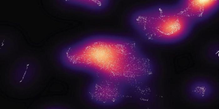 Some People May be Predisposed to Metastasis if They Get Cancer