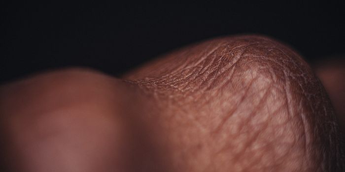 Simple Dietary Changes Could Help Ease Skin and Joint Inflammation