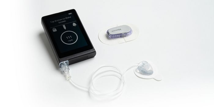 iLet Bionic Pancreas Clears FDA Hurdle, Now Commercially Available for Type 1 Diabetes Patients