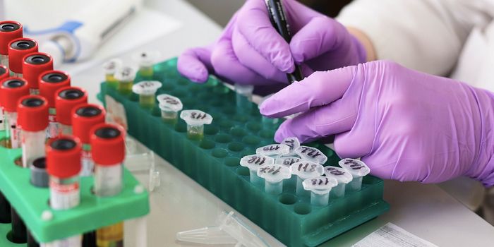 A Gut Microbe That May Lead to Rheumatoid Arthritis is Identified