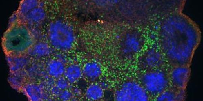 Newly Found Genes are Critical to Human Brain Development