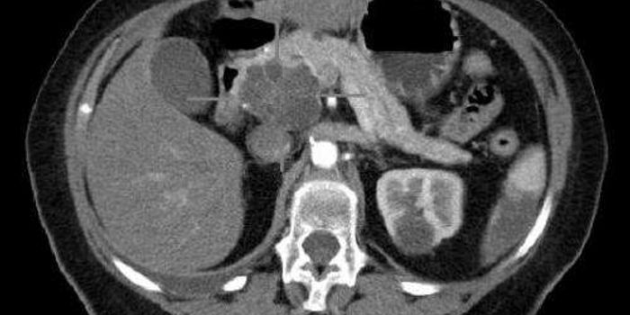 Scientists Turn Cancer Cells into Normal Cells