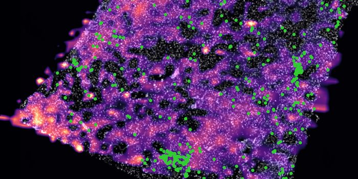 How the Tumor Microenvironment Can Disarm Immunity
