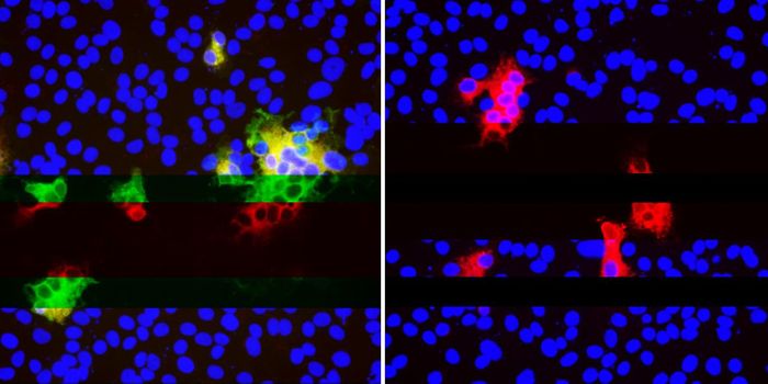 SARS-CoV-2 Can Selectively Delete Some Parts of Its Genome